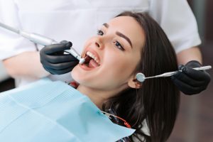 La pulizia professionale dei denti