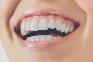 Le vitamine che servono per la salute dei nostri denti