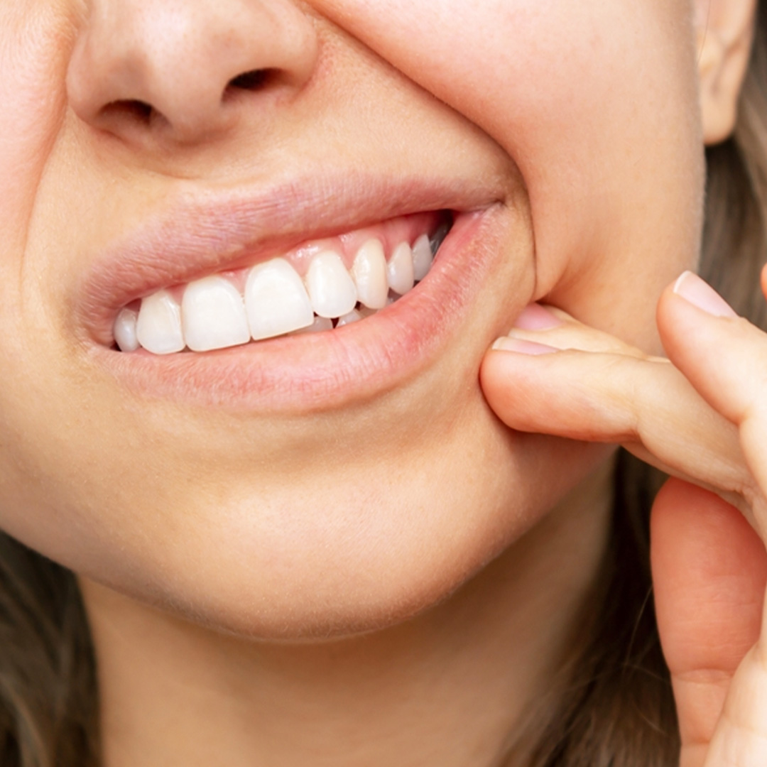 Lo sbiancamento dentale può alterare la sensibilità del tuo sorriso.