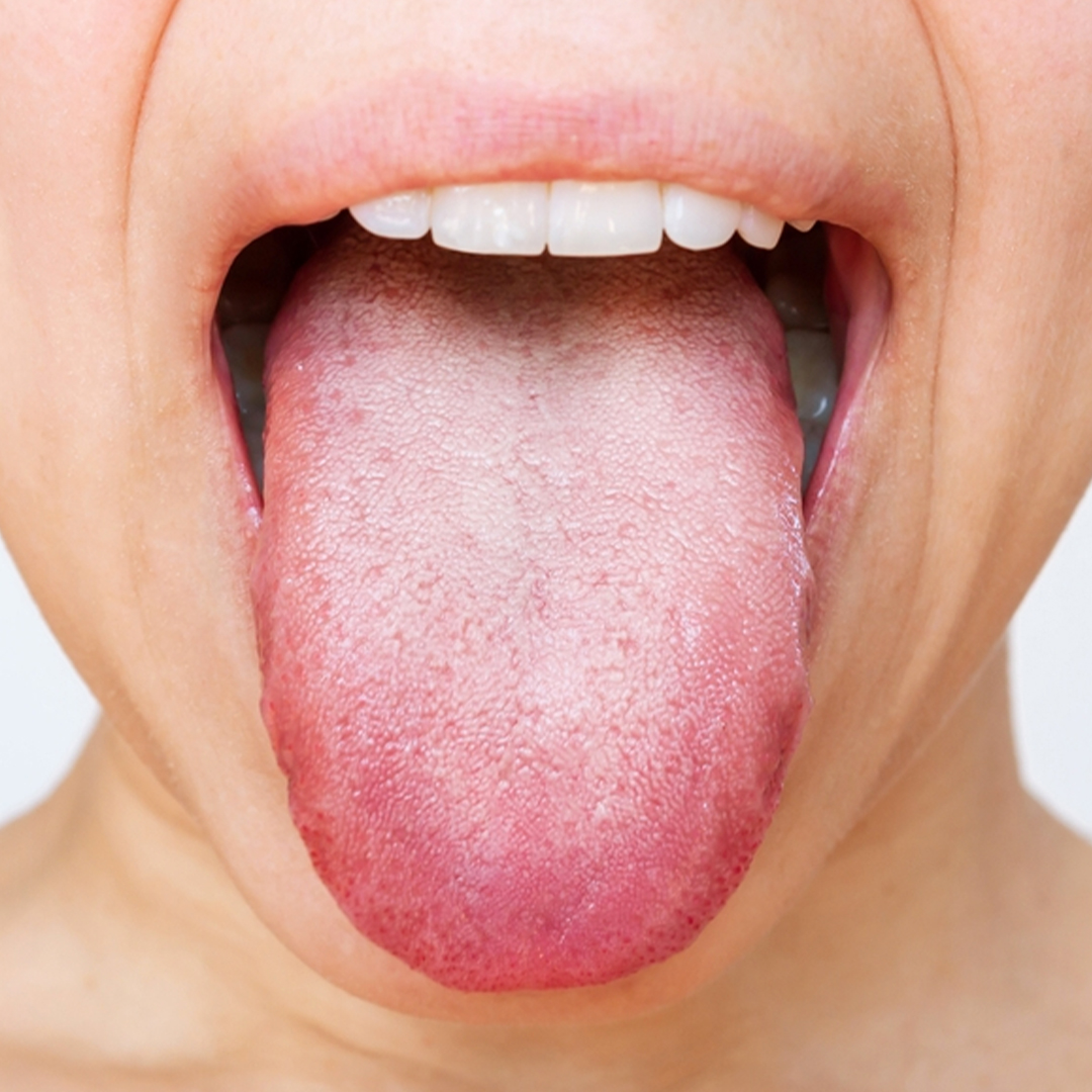 Tra flora batterica e salute orale esiste una stretta connessione